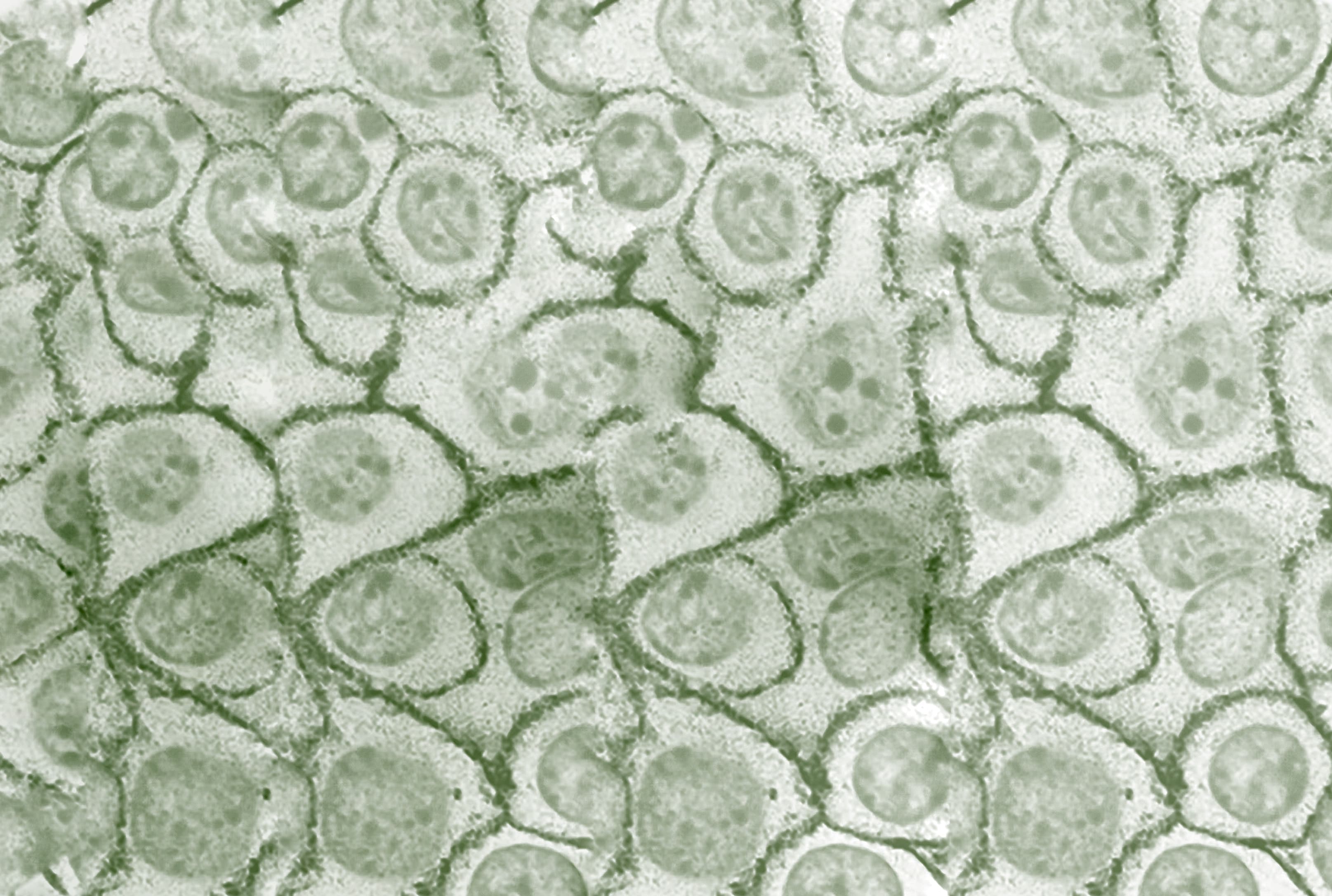 Qué es el DigeZyme®